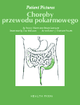 Choroby przewodu pokarmowego