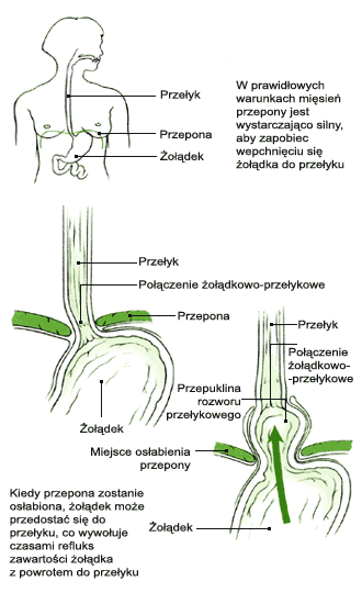 JestemChory.pl